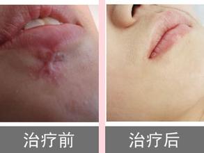 上海整形界隆鼻領(lǐng)域大咖評(píng)選，謝衛(wèi)國、王艷、范榮杰脫穎而出，你最喜歡哪位？