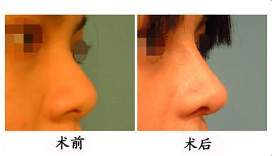 唐山五位優(yōu)秀整形醫(yī)生，詳細(xì)解析醫(yī)院口碑推薦名單