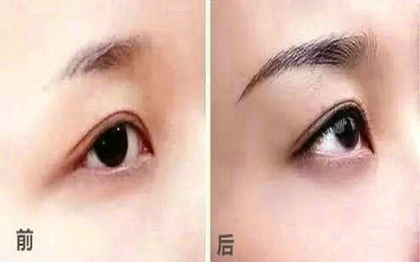 廣州鼻修復(fù)行業(yè)權(quán)威醫(yī)生徐媛、常輝彥、李闖等5位專家推薦