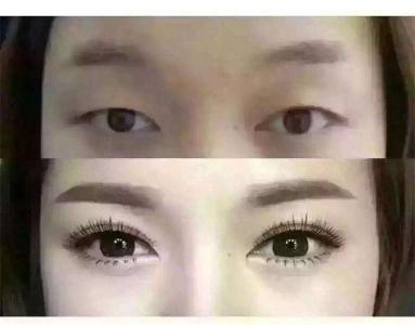 醫(yī)生對(duì)比：探討張龍與徐利剛的自然鼻子效果，從個(gè)人經(jīng)歷、專業(yè)評(píng)價(jià)對(duì)比來(lái)看