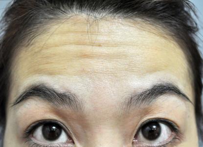 李圣利九院：鼻子整形的行家！醫(yī)生背景揭秘+病例評(píng)析！