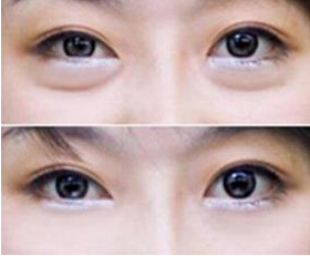 廣州韓妃沈紹勇為您打造完美鼻子，驚艷美貌值得擁有！