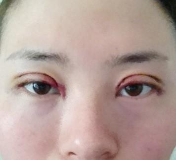 深圳受推崇的隆胸整形醫(yī)生TOP排行！醫(yī)師大牌云集，看看有沒有你熟悉的名字？