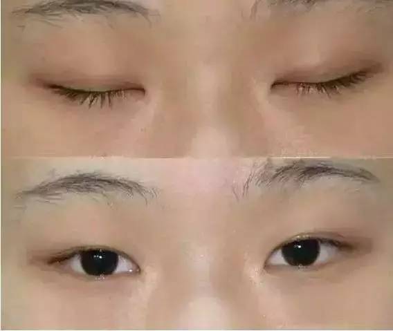 北京美鼻醫(yī)生榜單揭曉：五位專家，技術(shù)穩(wěn)定價(jià)格親民