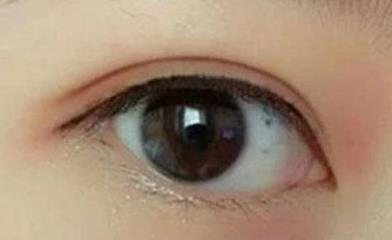 上海伊萊美整形醫(yī)院李湘，打造您美麗的新面容