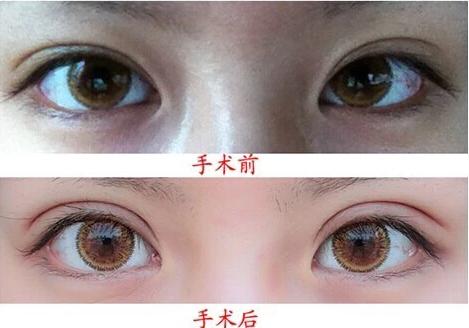 深圳鼻整形行業(yè)：揭秘醫(yī)生排行榜，五位實力派盡顯專業(yè)魅力，技術(shù)可靠提供？