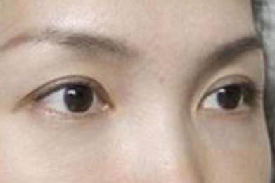 2023貴陽脂肪填充領(lǐng)域的醫(yī)師揭曉：李如杰、魯天宇、梁立漢贏得公眾口碑認(rèn)可