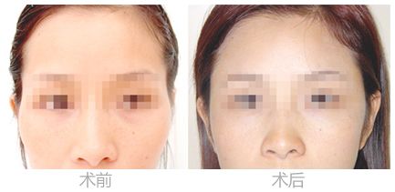 杜本軍整容手術怎么樣？專家評價_手術費用_醫(yī)療機構推薦