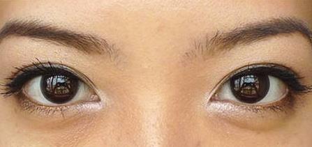 鄭州鼻王劉一刀醫(yī)生的個人經(jīng)歷分享，讓你了解他的專業(yè)水平