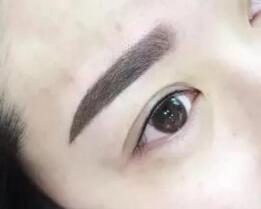 成都拇外翻手術(shù)醫(yī)院推薦，看過真實(shí)案例，令人稱贊！